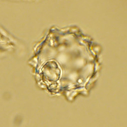 A palm phytolith, a microscopic particle of silica laid down in a plant cell