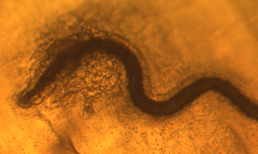 Nematode fixed in a snail shell