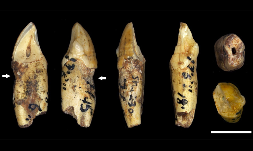 A row of fossilised teeth