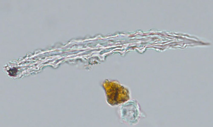 Wild breadfruit phytolith, a microscopic particle of silica laid down in plant cells