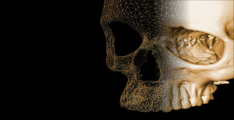 DigiArt skull meets 3D - an Australian aboriginal skull of a female individual from the Evan repository